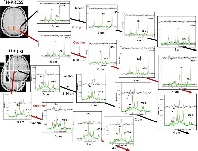 Brain metabolite changes during sleep deprivation with creatine supplementation