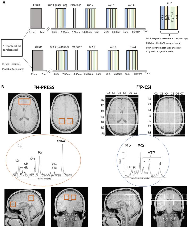 Study design showing creatine supplementation and cognitive testing timeline during sleep deprivation